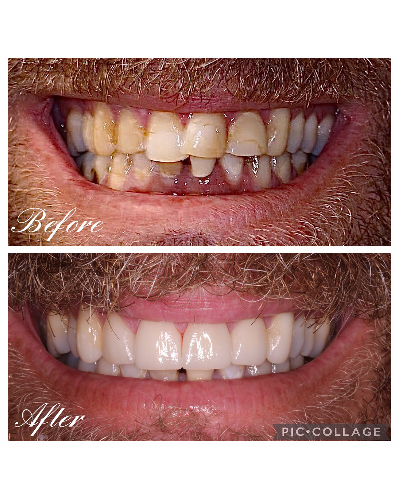 Restorations-before-and-after-2